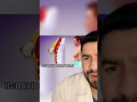 ASI ES LA C1RUG14 PARA TRATAR LA GINECOMASTIA