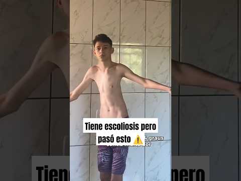Tenía escoliosis pero hizo esto #gym #escoliosis #fitness #bodybuilding